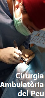 Cirurgia Ambulatòria del Peu